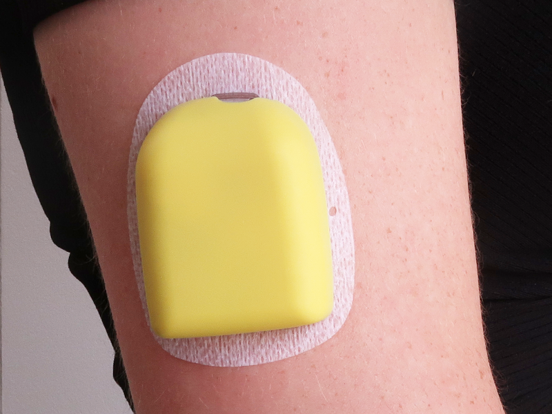 Omnipod Cover - Mellow Yellow